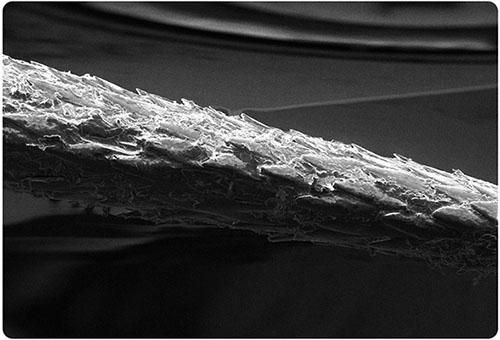 A 150x magnified view of a porcupine quill showing backwardfacing barbs on the tip tip is to the right Photo courtesy Kathryn Everson used with permission Everson Lab at Oregon State University httpswwweversonlaborg