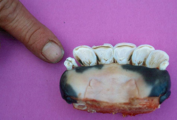 Bison teeth with human finger for scale